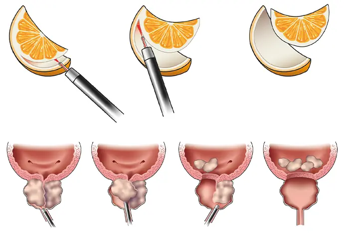 img-cirurgia